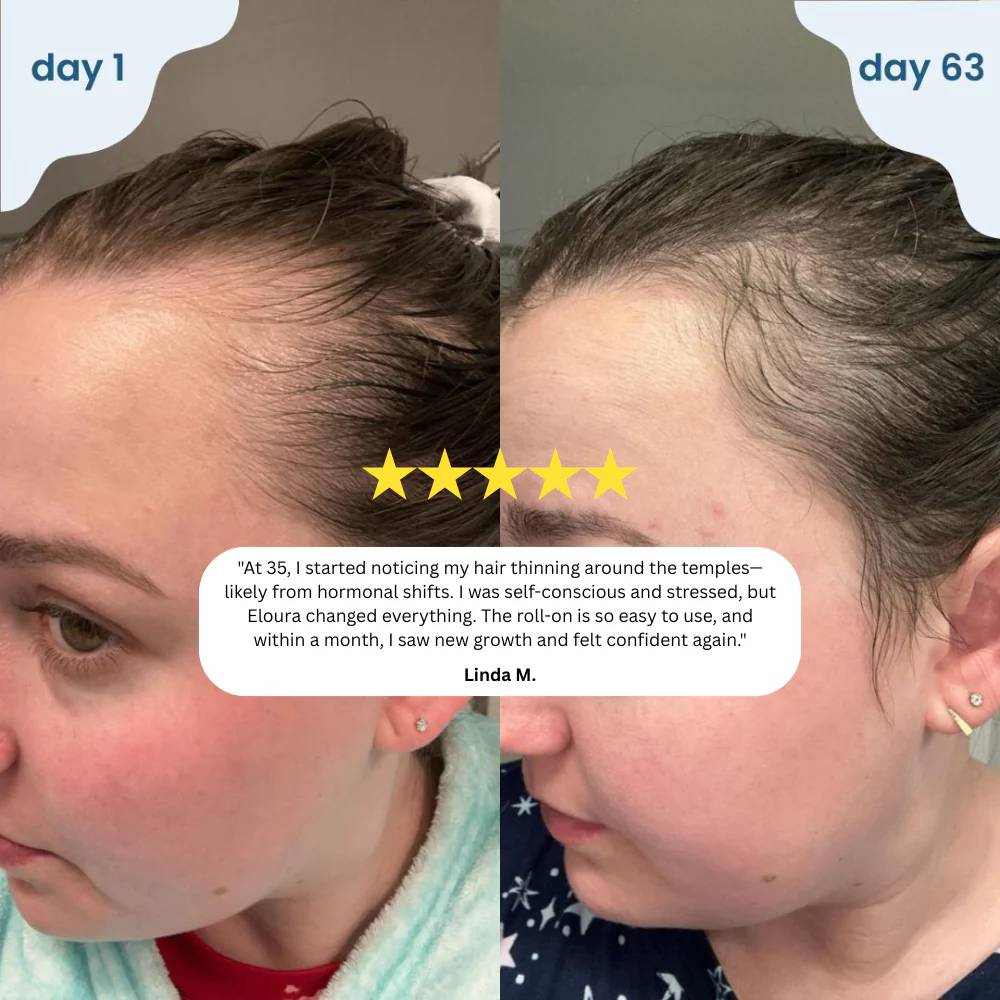 Vitas Hair Growth Serum